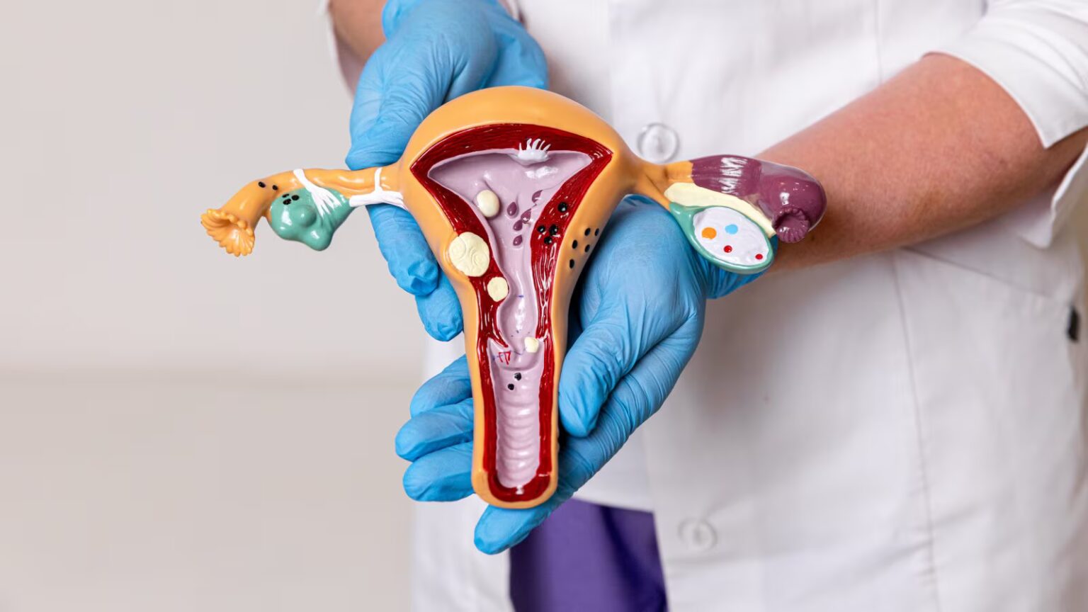 Can PCOS increase your diabetes risk? Here’s what every woman should know