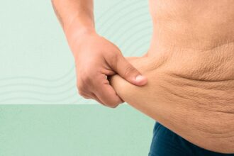 7 Things No One Tells You About Weight Loss and Excess Skin