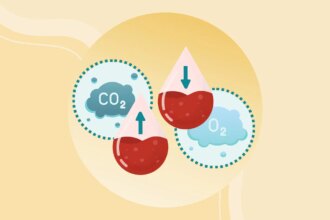 What Is Pickwickian Syndrome (or Obesity Hypoventilation Syndrome)?