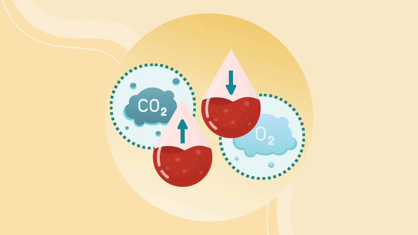 What Is Pickwickian Syndrome (or Obesity Hypoventilation Syndrome)?